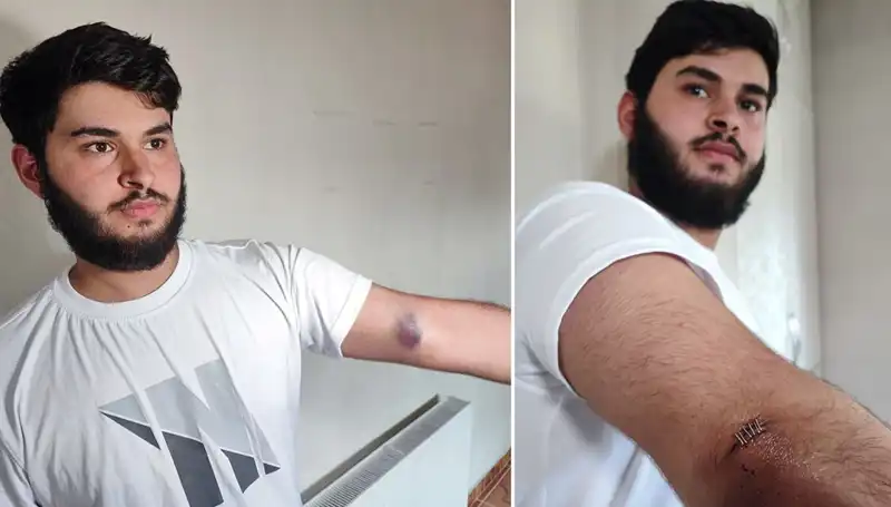 Bahçeye Kaçan Top Mahallede Kaosa Neden Oldu: Conolar Kamyonetle Geldi!